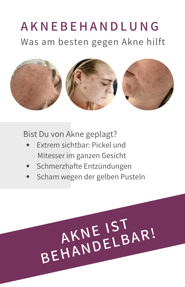 Akne Bad Langensalza Behandlung
