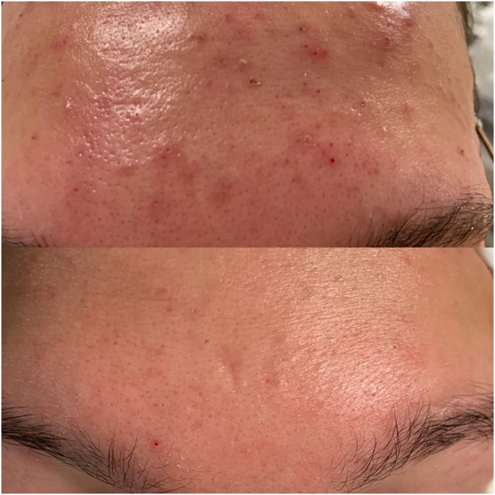 Akne Studio MK Beauty Art Bad Langensalza