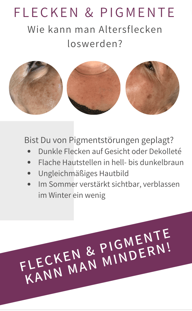 Altersflecken Pigmentstörung Bad Langensalza Behandlung