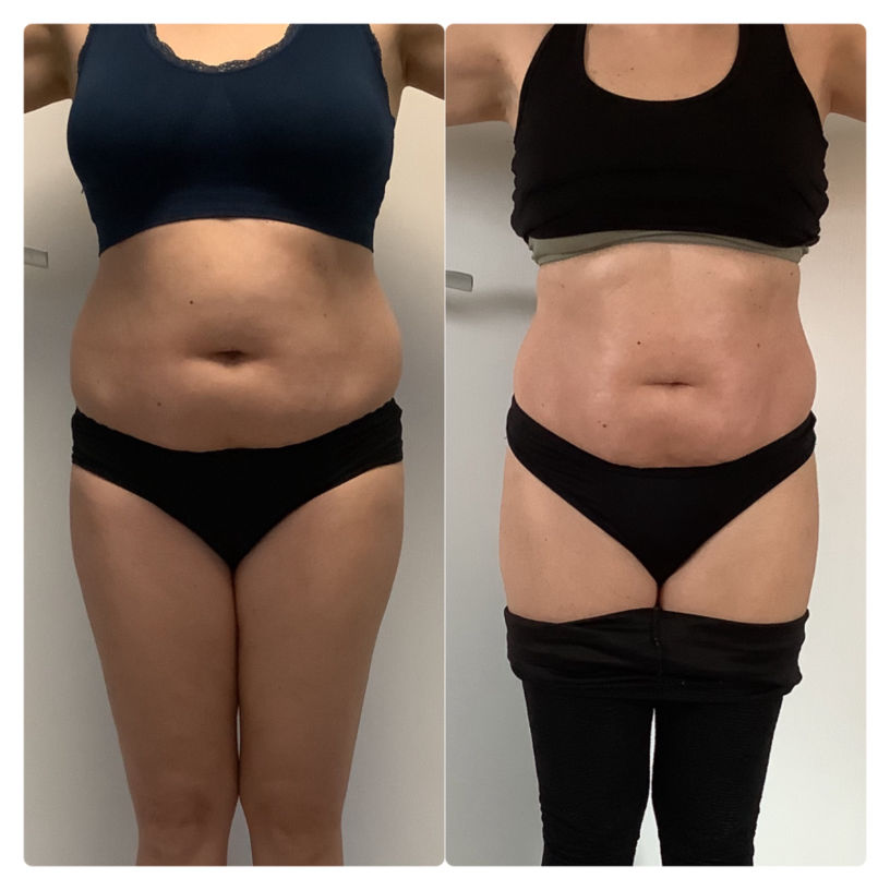 Jordi Shape Studio MK Beauty Art Bad Langensalza