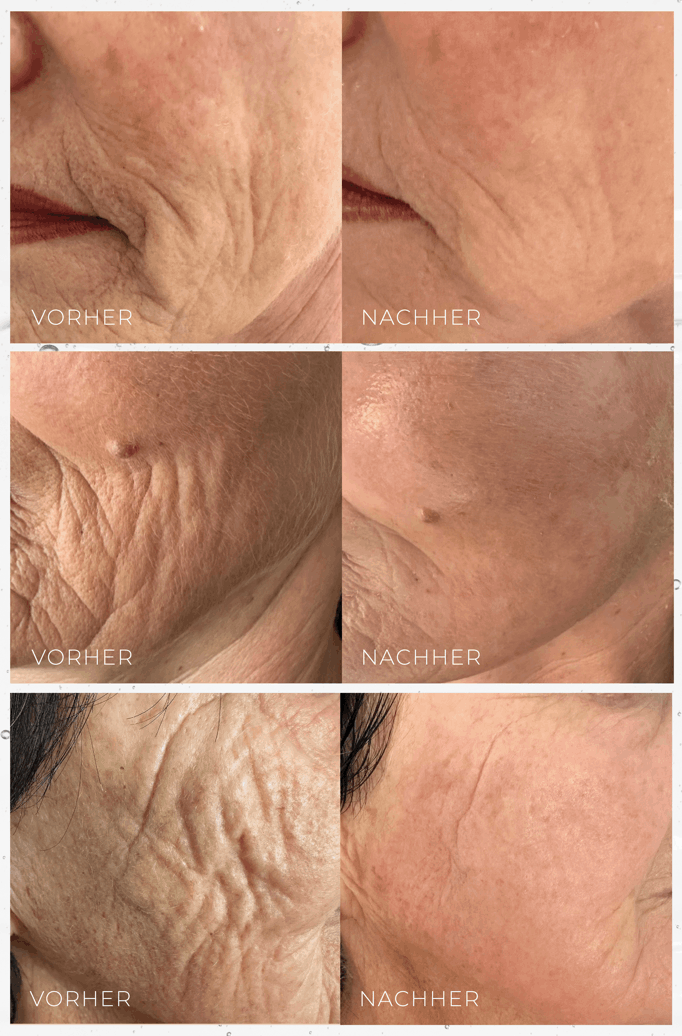 Futuracontour Thüringen bad Langensalza, Erfurt, Gotha, Mühlhausen