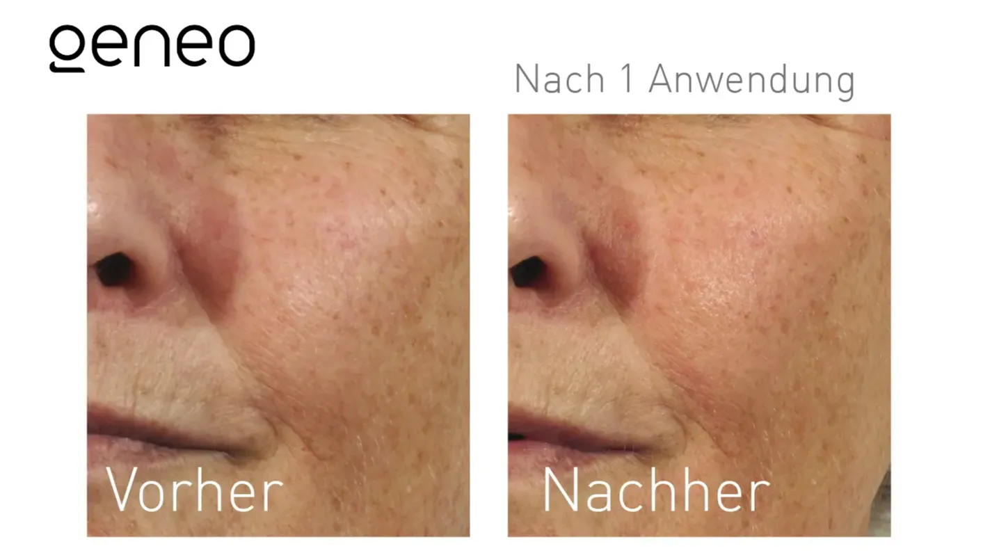 Oxygeneo® Studio MK Beauty Art Bad Langensalza