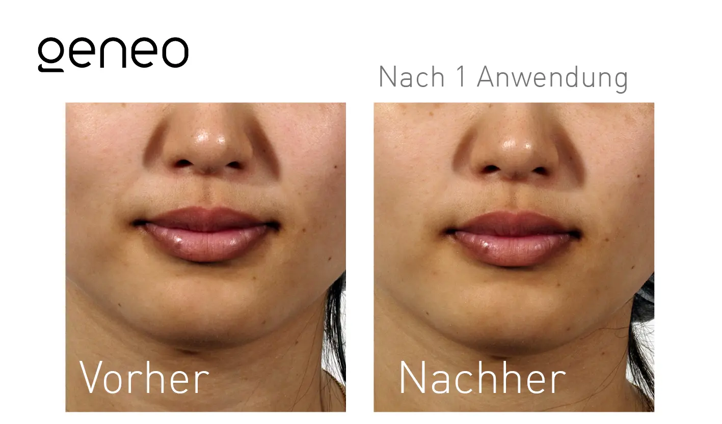 Oxygeneo® Studio MK Beauty Art Bad Langensalza