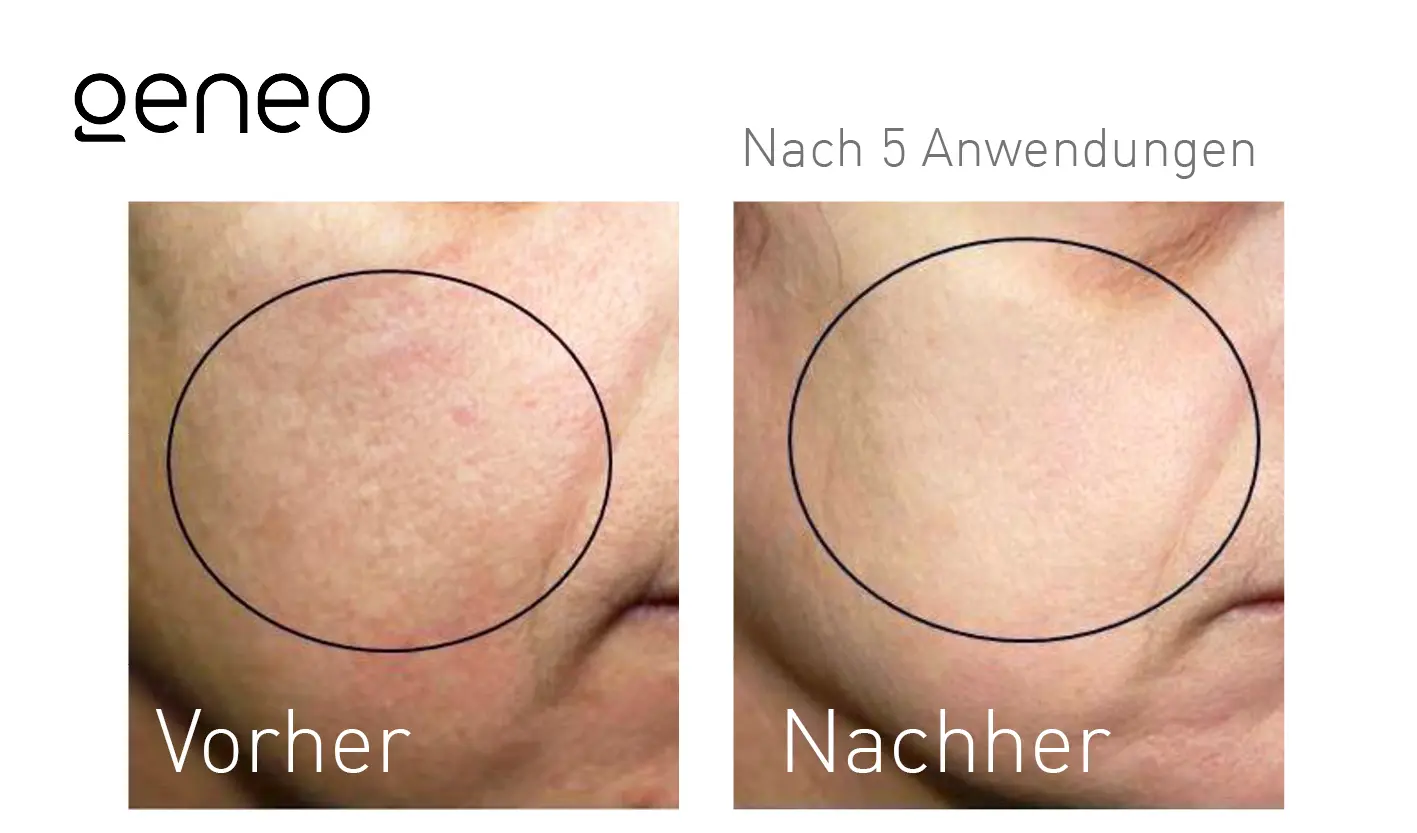 Oxygeneo® Studio MK Beauty Art Bad Langensalza