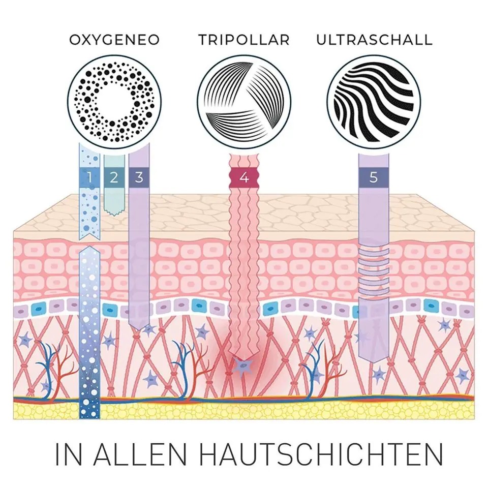 Geneo Technologie Hautschichten in Bad Langensalza, Mühlhausen, Gotha, Erfurt