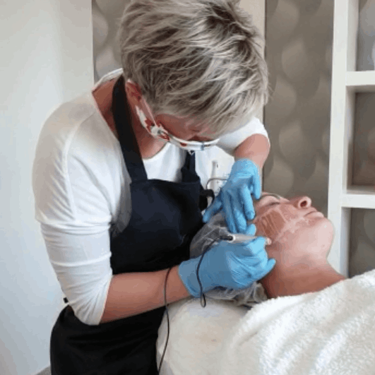 Microneedling in Thüringen MK Beauty Art Academy