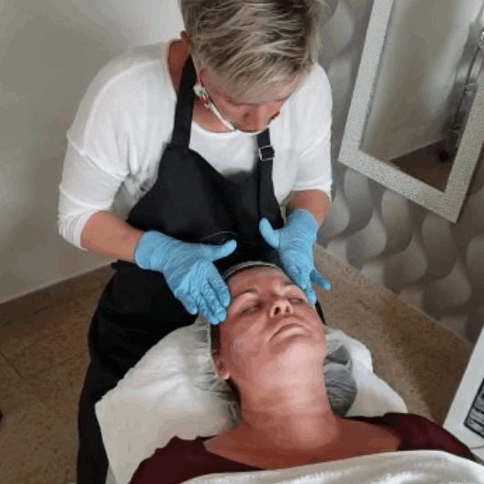 Nachbehandlung Microneedling in Thüringen MK Beauty Art Academy