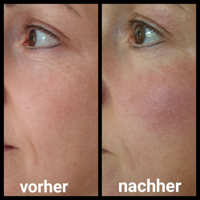 Akne Studio MK Beauty Art Bad Langensalza