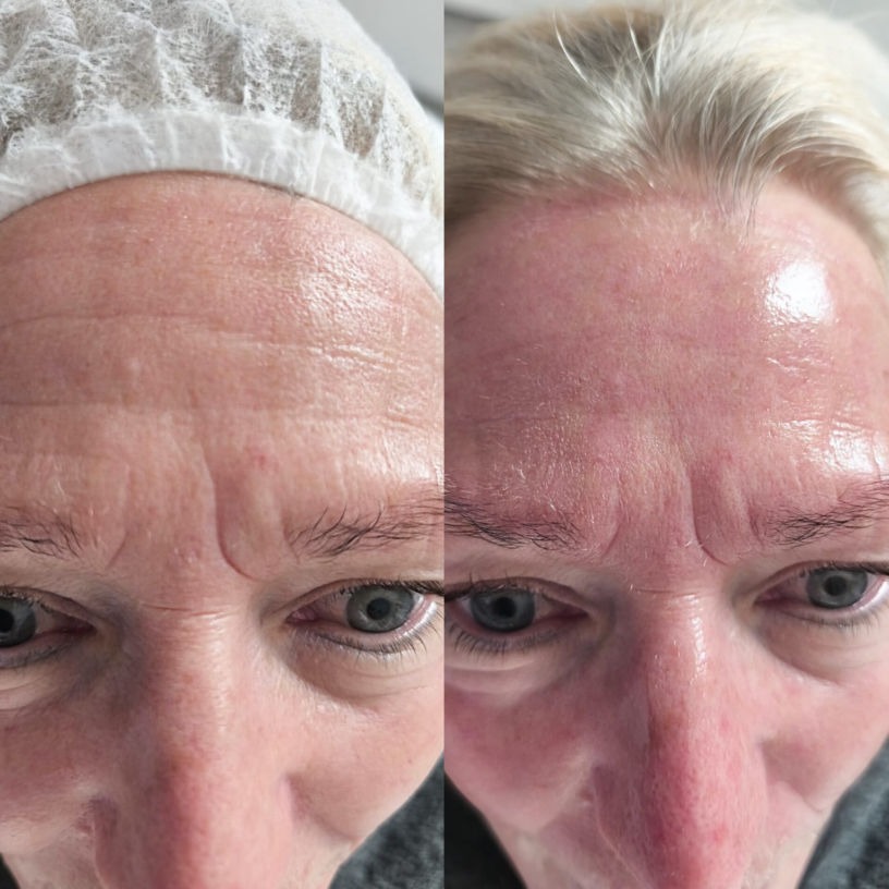 FUTURACONTOUR® Studio MK Beauty Art Bad Langensalza