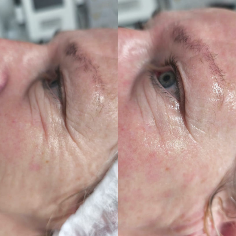 FUTURACONTOUR® Thüringen Studio MK Beauty Art Bad Langensalza